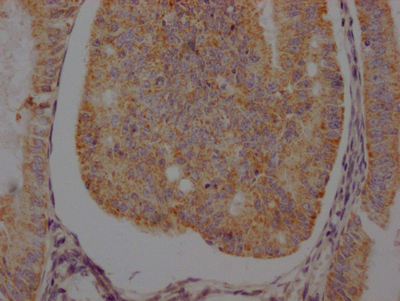 CSB-RA286054A0HU