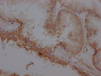 CSB-RA286054A0HU