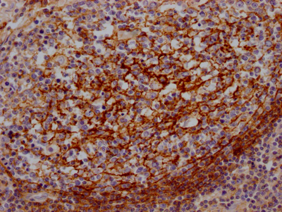 CSB-RA440943A0HU