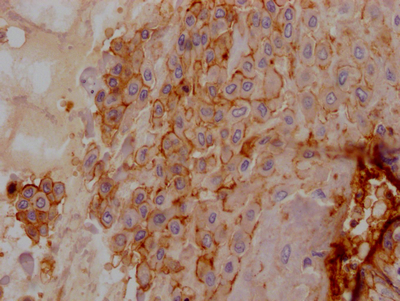 CSB-RA440943A0HU