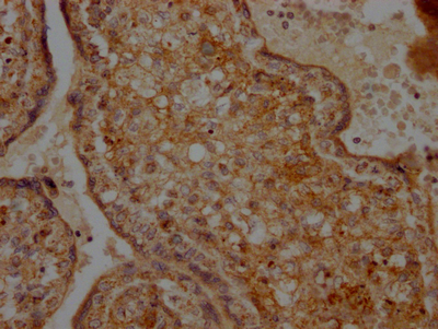 CSB-RA441307A0HU