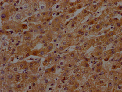 CSB-RA553053A0HU