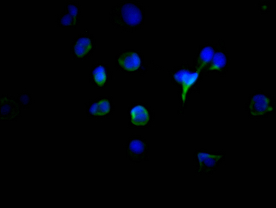 CSB-RA567167A0HU