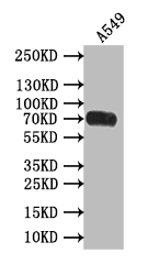 CSB-RA567944A0HU WB