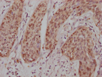 CSB-RA911286A0HU