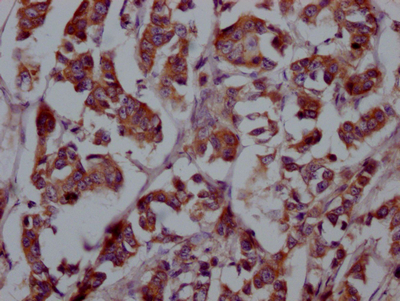 CSB-RA927449A0HU