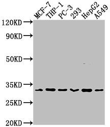 CSB-RA934881A0HU WB