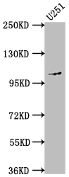 CSB-RA940661A0HU
