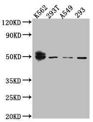 CSB-RA950156A0HU