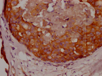 CSB-RA951649A0HU
