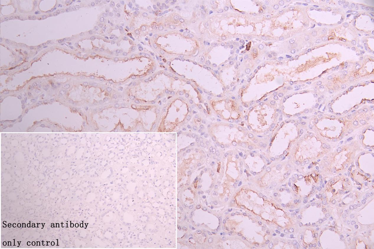 CSB-RA974628A0HU