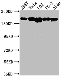 CSB-RA983271A0HU WB
