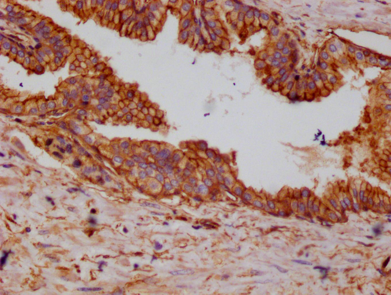 CSB-RA987782A0HU
