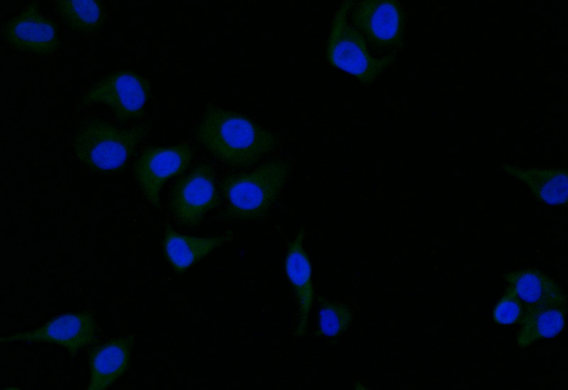 CSB-RA989713A0HU