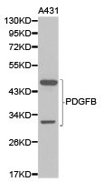 CSB-PA017709KA01HU