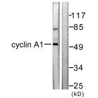 CSB-PA068470