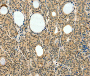 CSB-PA956774
