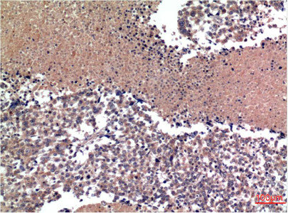CSB-MA124445