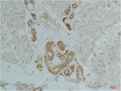 CSB-PA450853