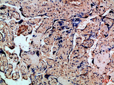 CSB-PA821914