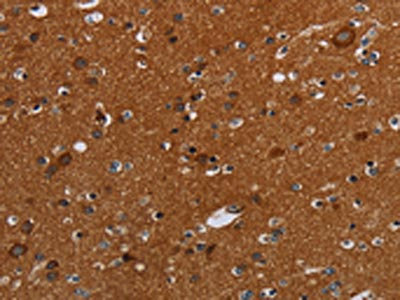 CSB-PA041473