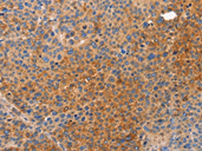 CSB-PA047815