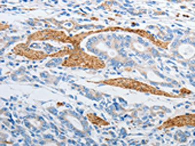 CSB-PA068736