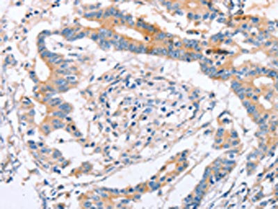 CSB-PA139477