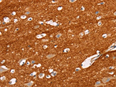 CSB-PA139477