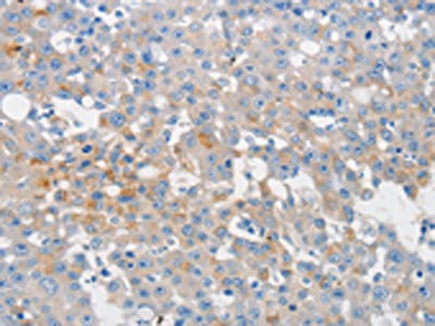 CSB-PA154128
