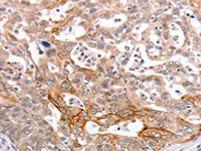 CSB-PA176370
