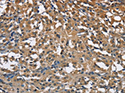 CSB-PA205920