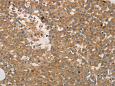 CSB-PA207627