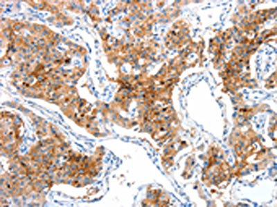 CSB-PA240615
