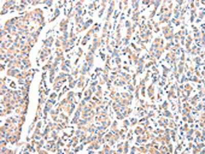 CSB-PA240615