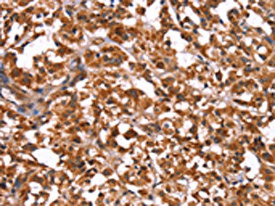 CSB-PA247916