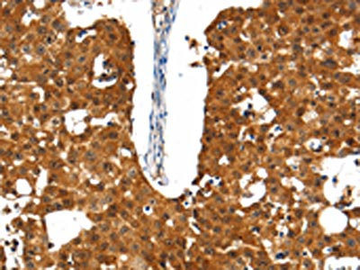 CSB-PA254587