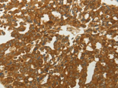 CSB-PA254627