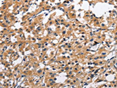 CSB-PA254797