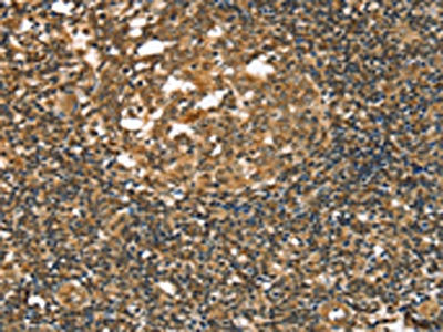 CSB-PA316150