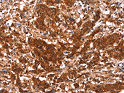 CSB-PA547529