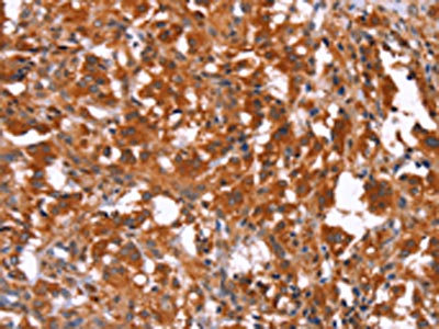 CSB-PA547529