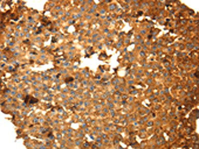 CSB-PA568903
