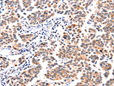 CSB-PA823966