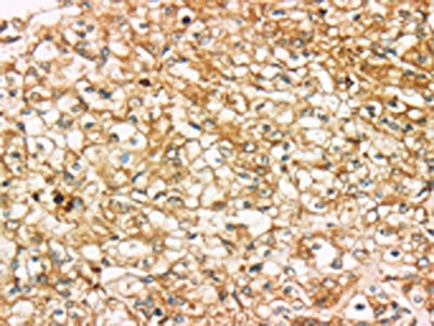CSB-PA975446