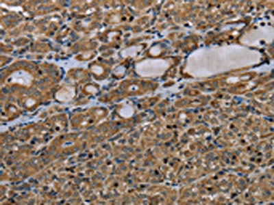 CSB-PA984896 IHC
