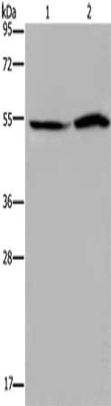 CSB-PA041473