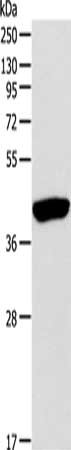 CSB-PA240615