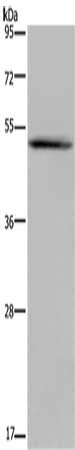 CSB-PA299262 WB