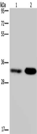 CSB-PA547925